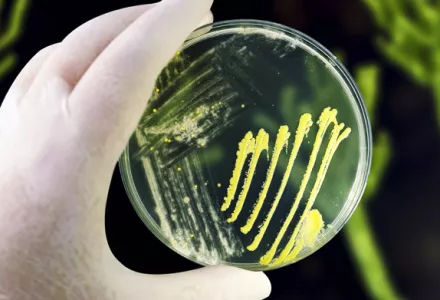 Gloved hand holding a petri dish with yellow microbial growth for plant health improvement.
